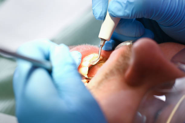 Best Dentist for Severe Toothache  in Richmond, VA
